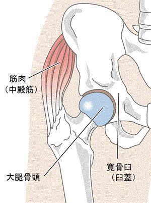 人工 骨頭 置換 術 脱臼